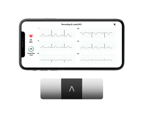 KardiaMobile 6-Lead Personal EKG Monitor ?C Six Views of The Heart ?C Detects AFib and Irregular Arrhythmias ?C Instant Results in 30 Seconds ?C Works with Most Smartphones - FSA/HSA Eligible